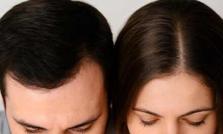 The Best Hair Care Products for Sensitive Scalp: What to Look For and Why It Matters